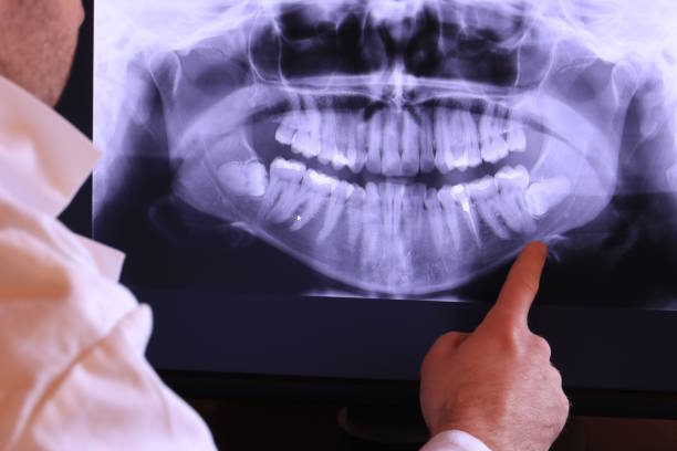 Best Broken or Cracked Tooth Emergency Dentist in Bedford, VA